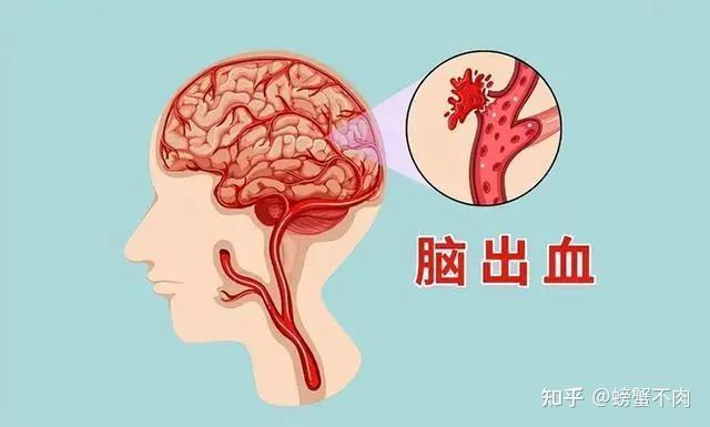 高血压的危害你注意了吗？